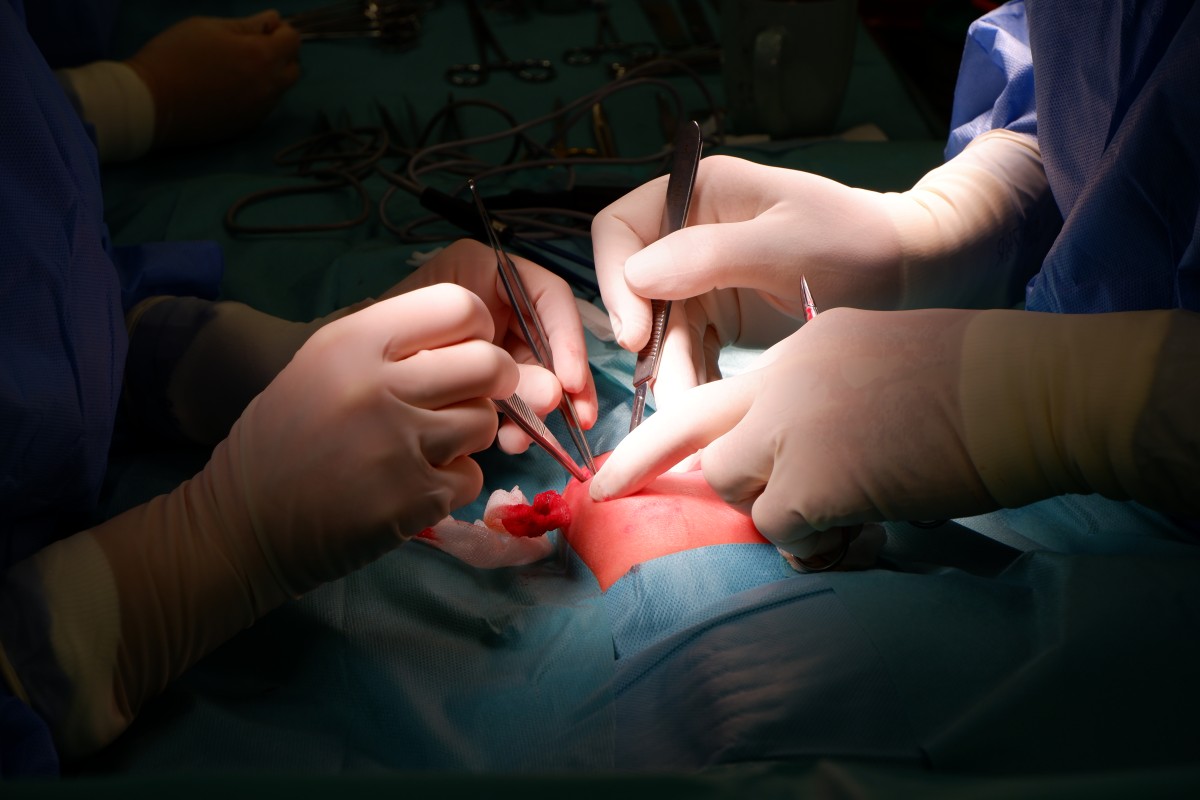 operacja małego pacjenta